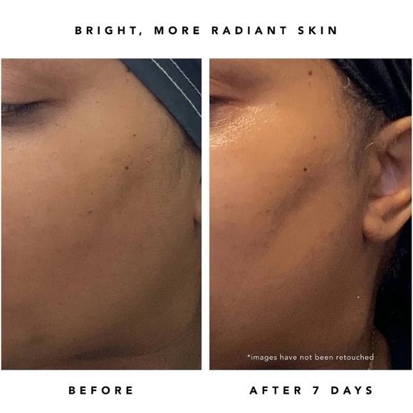 New Herbivore NOVA 15% Vitamin C + Turmeric Brightening Serum 30ml Sephora - Picture 7 of 9